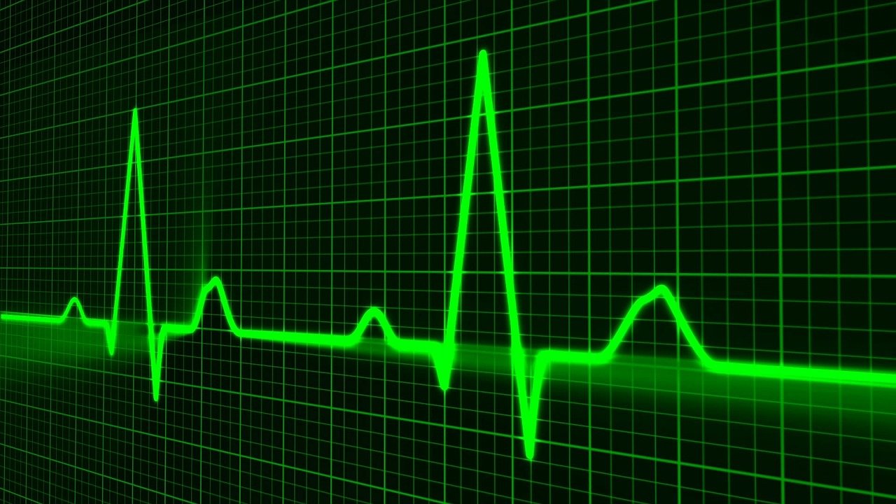 pulse trace, healthcare medicine, heartbeat
